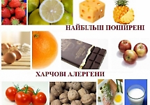 Харчова алергія